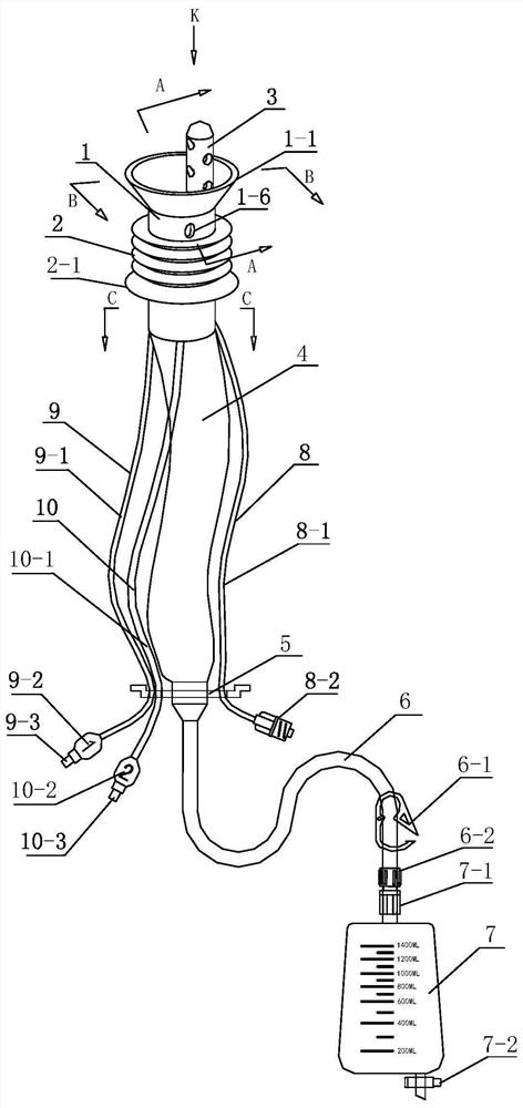 Rectum anastomotic stoma protection device and operation method