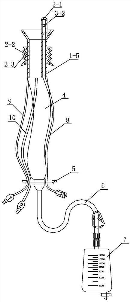 Rectum anastomotic stoma protection device and operation method