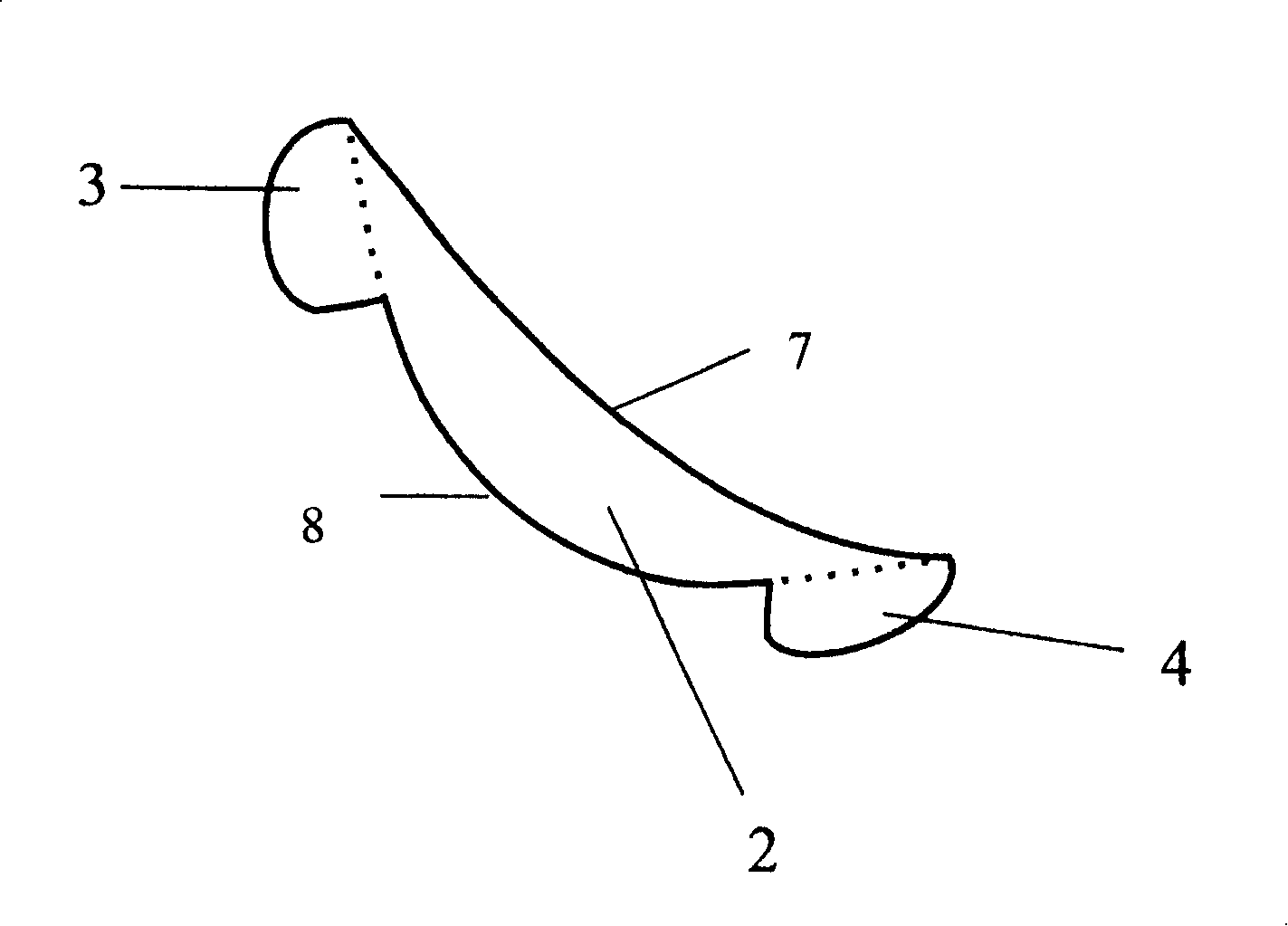 Shaping-area limiting device for angle of mandible and making method therefor