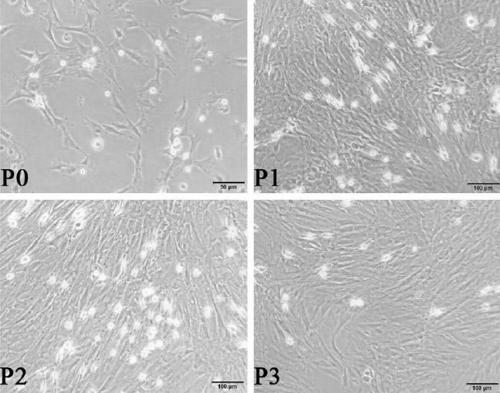 Application of Rspo1 to induce differentiation of bone marrow mesenchymal stem cells into cardiomyocyte-like cells