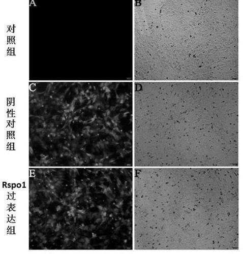 Application of Rspo1 to induce differentiation of bone marrow mesenchymal stem cells into cardiomyocyte-like cells