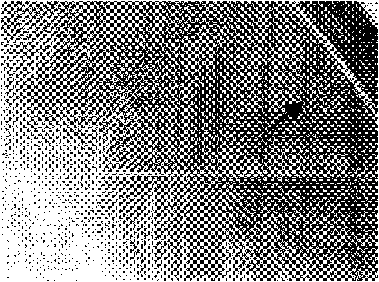 Method for improving tumor cell cloning efficiency