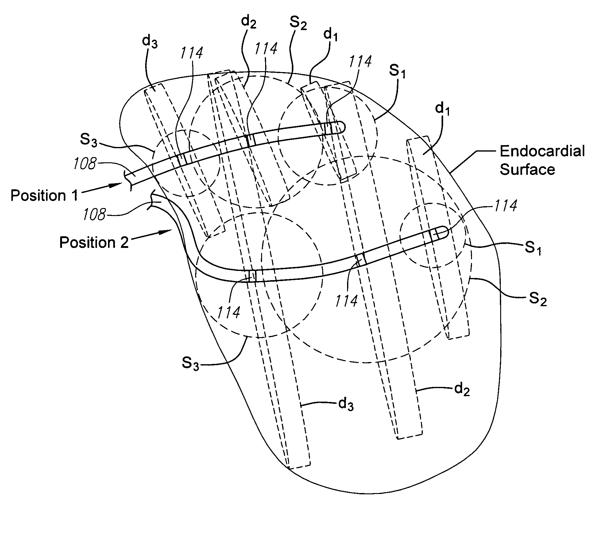 System and method of graphically generating anatomical structures using ultrasound echo information
