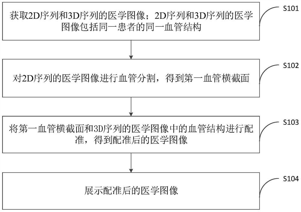 Image display method, computer equipment and storage medium