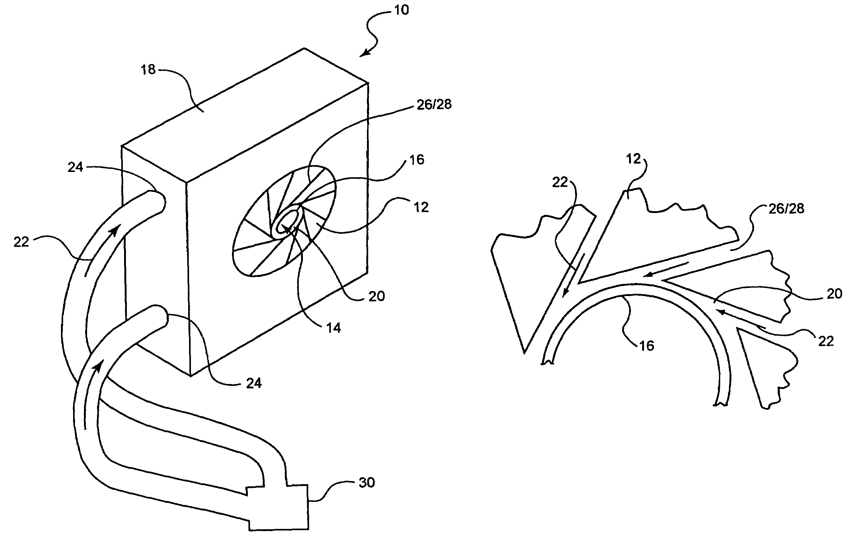 Stent reducing system and device