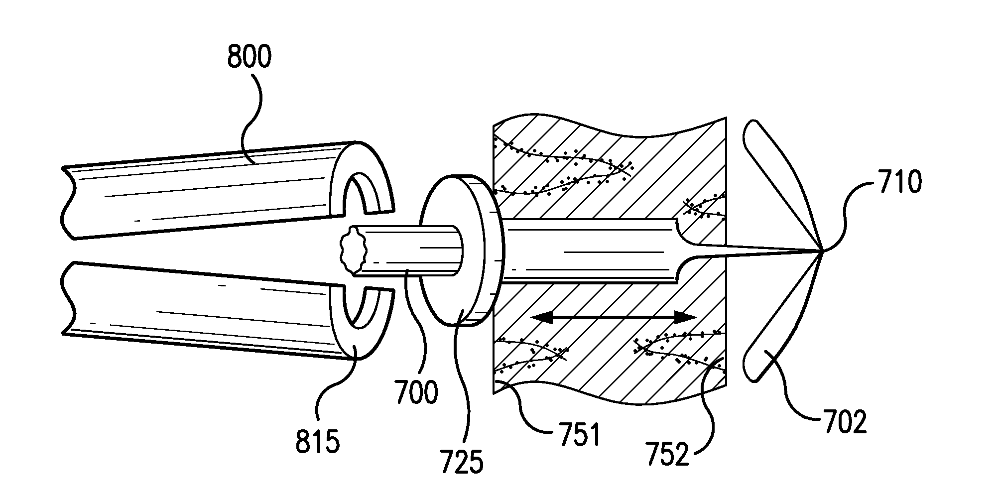 Tissue repair implant and delivery device and method
