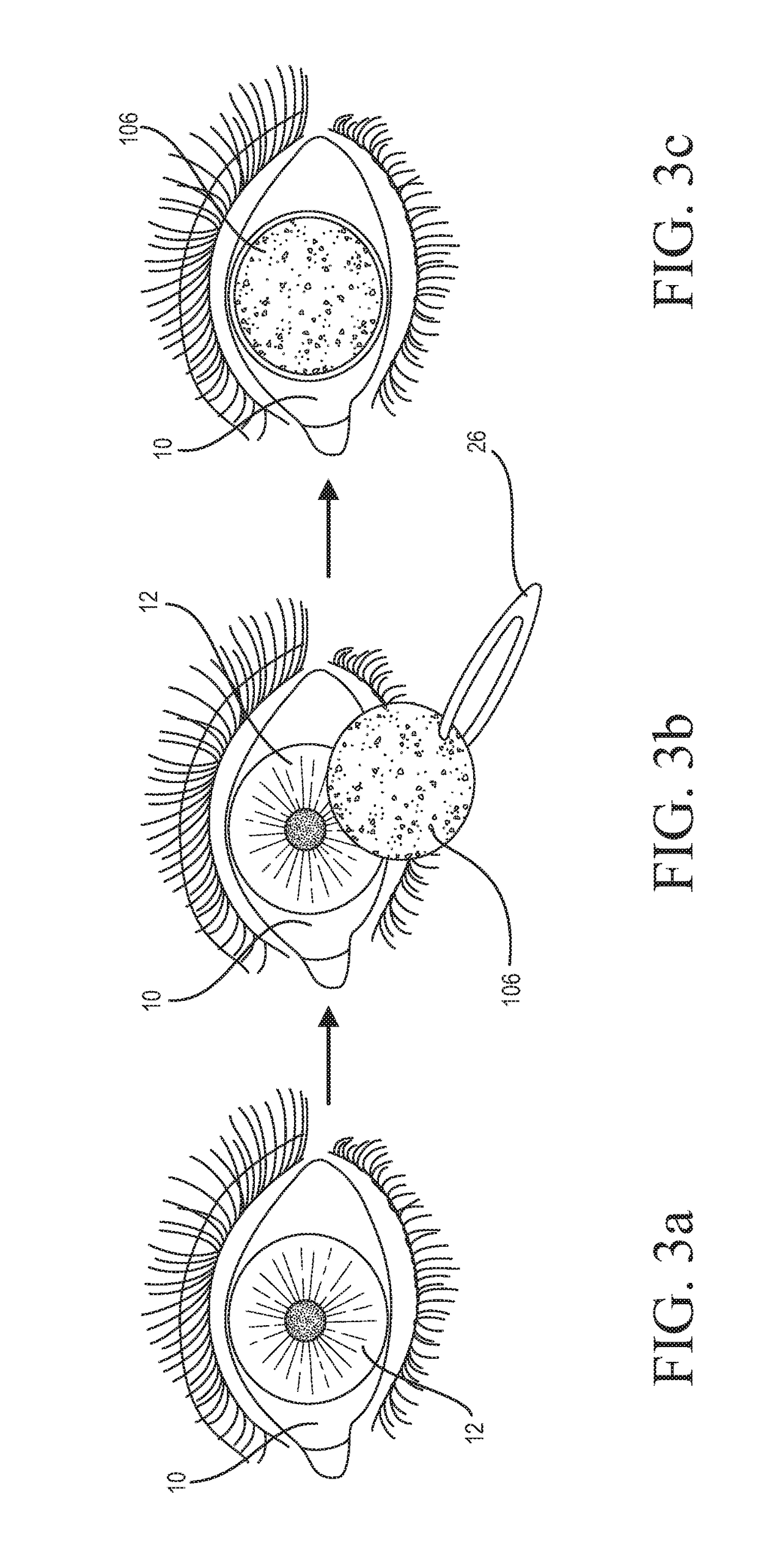 System and method for the delivery of medications or fluids to the eye