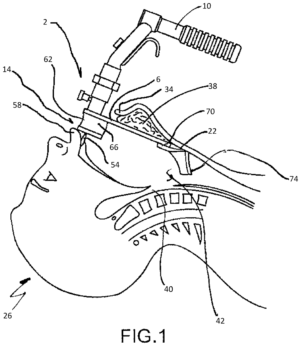 Retractor and tip extender therefor