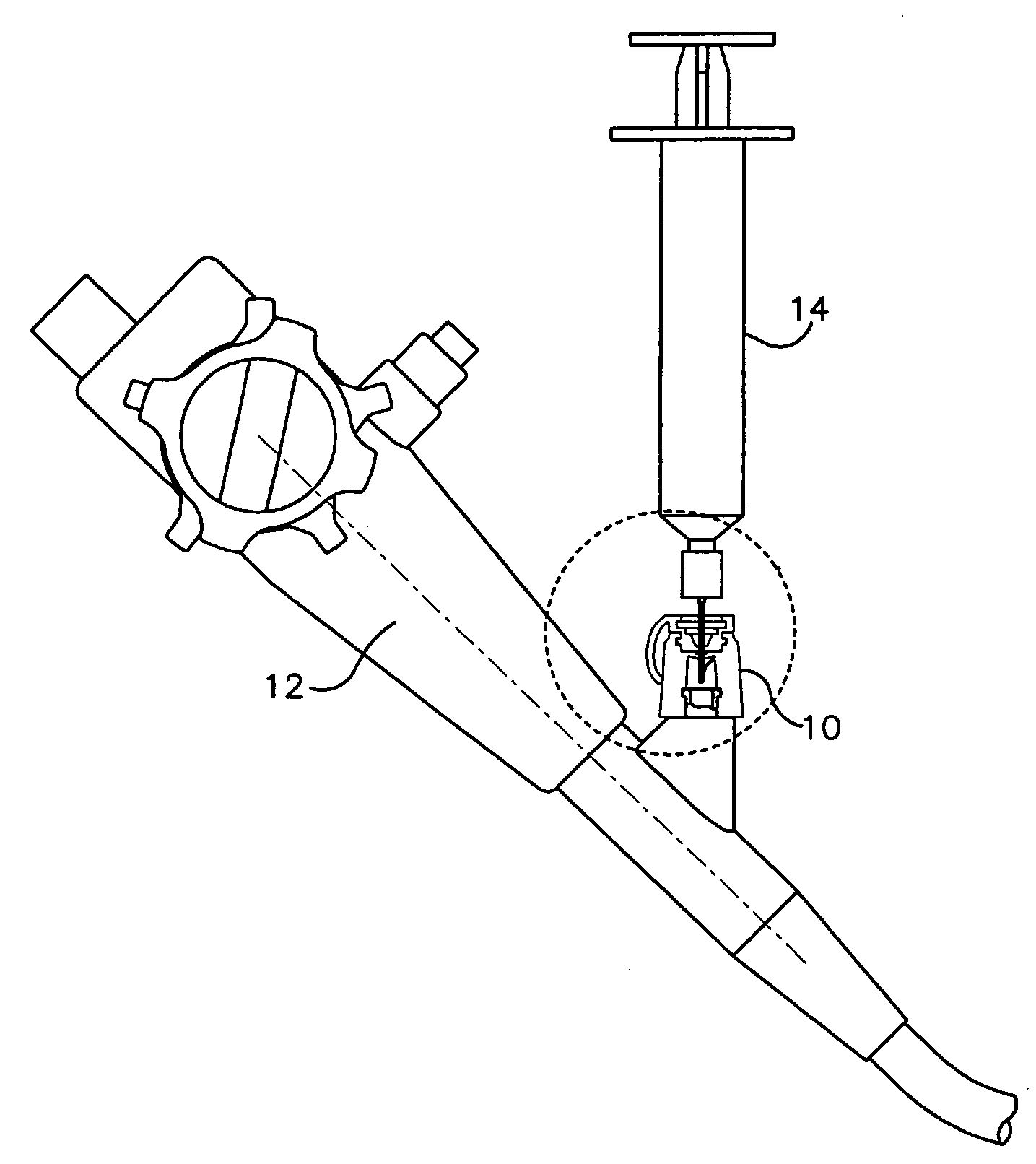 Irrigating biopsy inlet valve