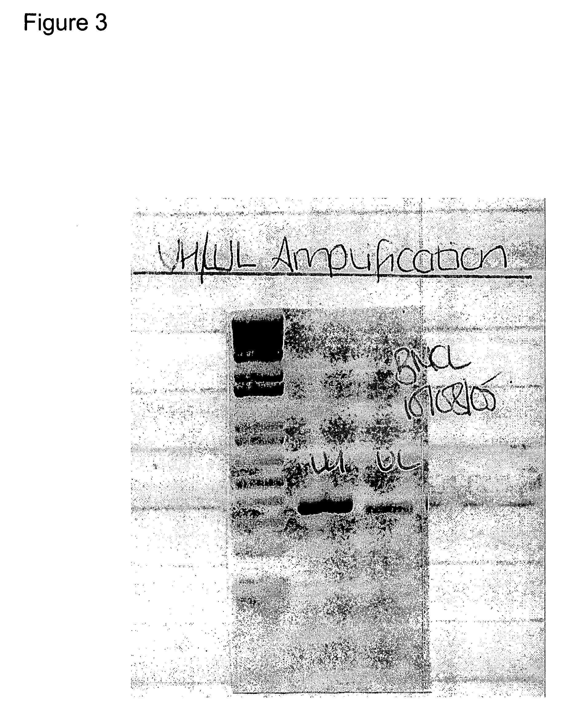 Anti-p-selectin antibodies and methods of using the same to treat inflammatory diseases