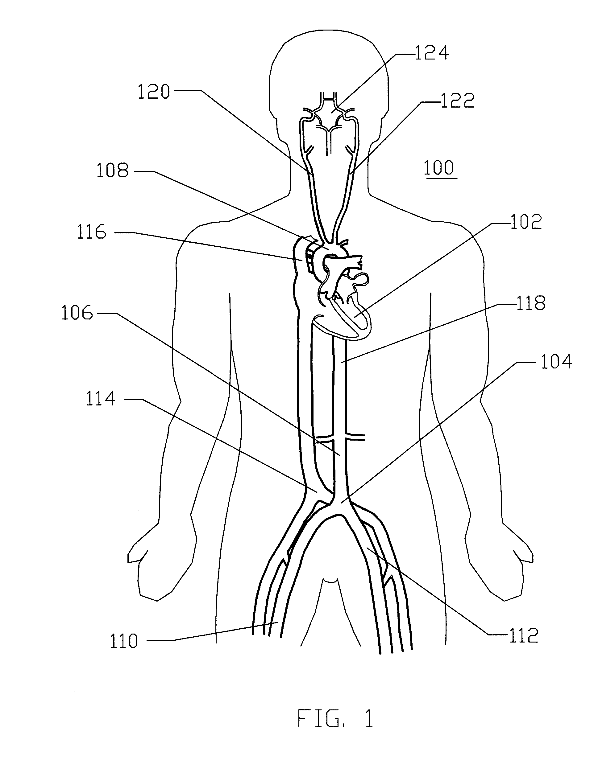 Expandable cerebrovascular sheath and method of use