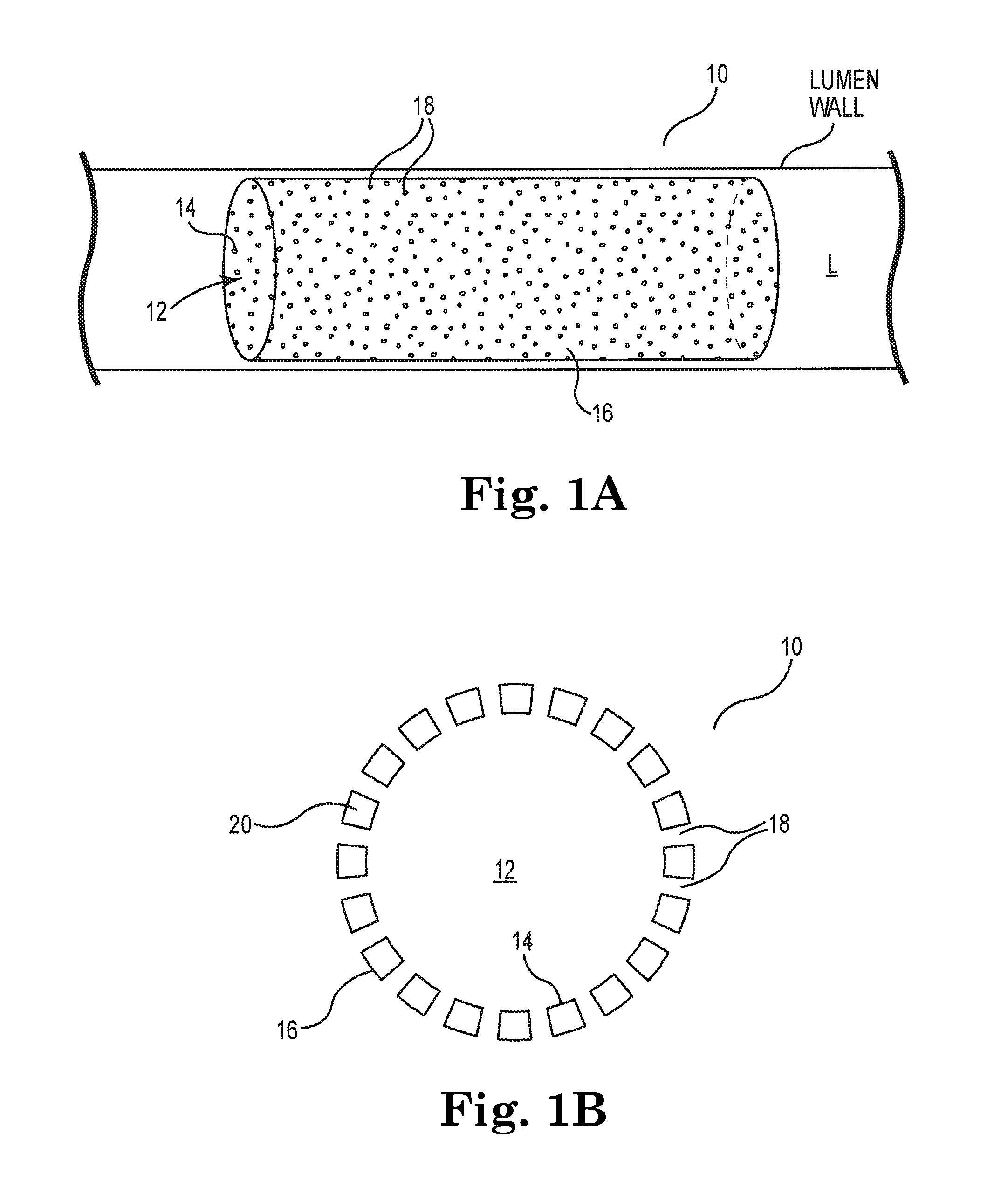 Therapeutic agent delivery system and method for localized application of therapeutic substances to a biological lumen