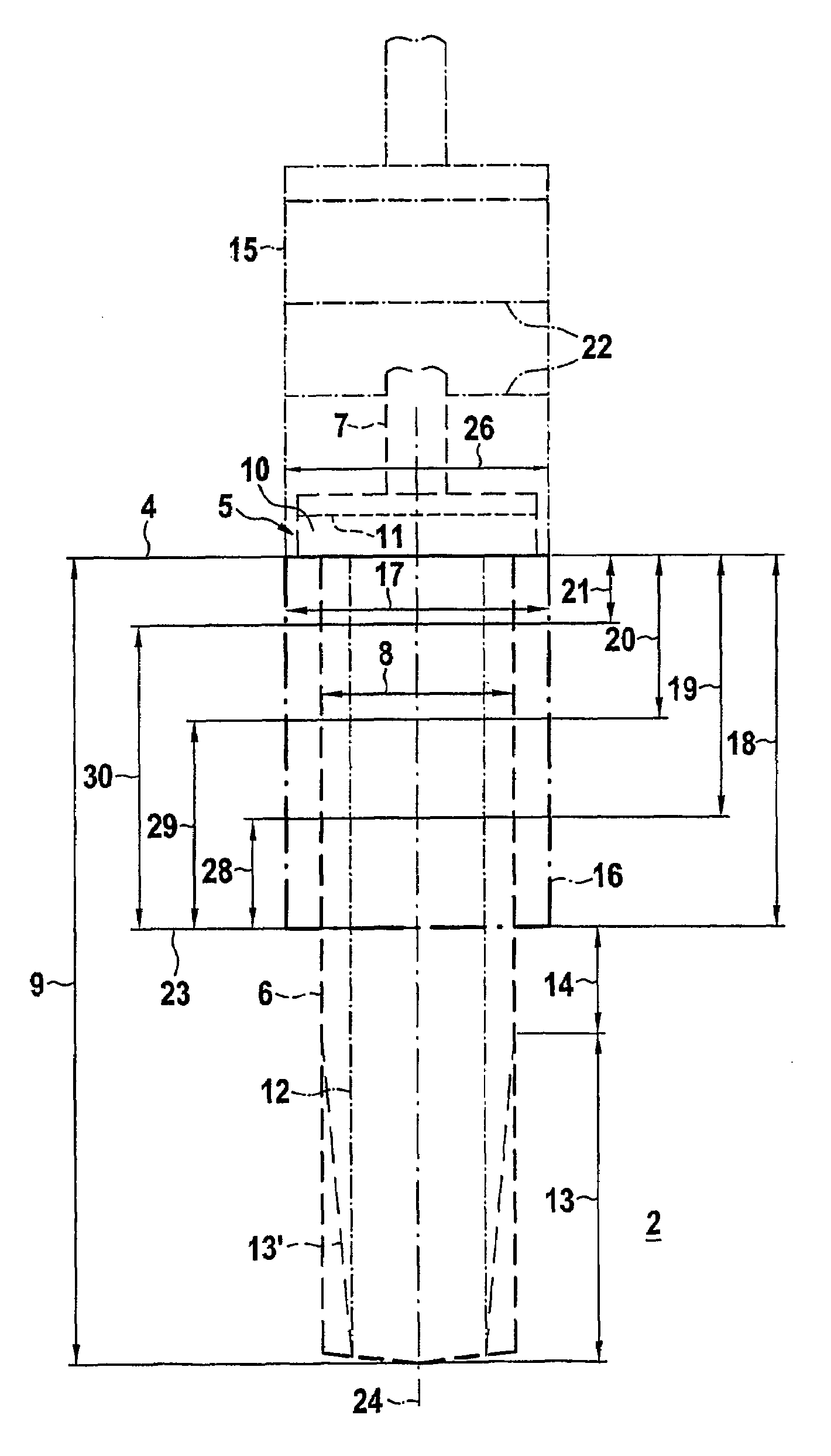 Implant system