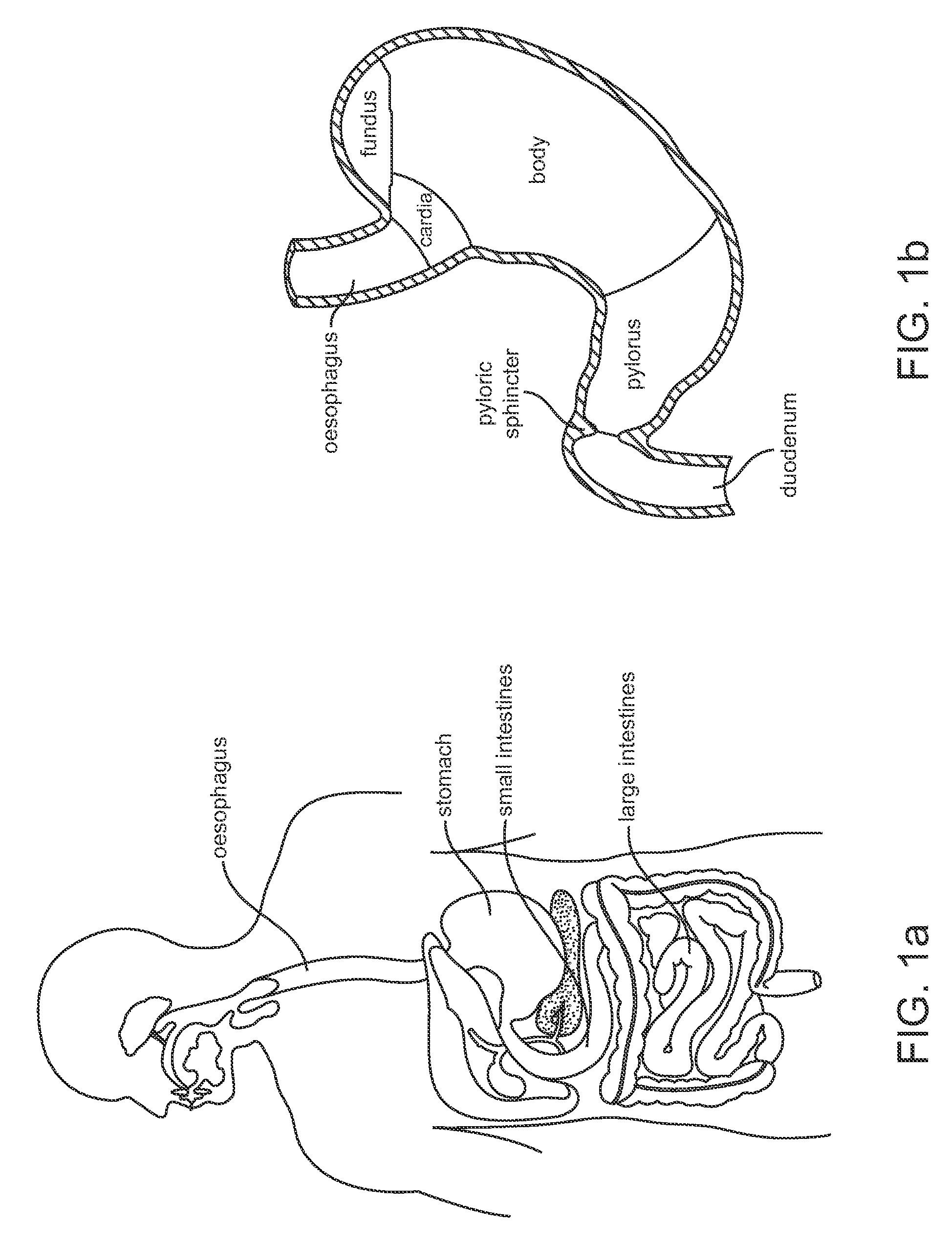 Systems and methods for implantable leadless gastrointestinal tissue stimulation