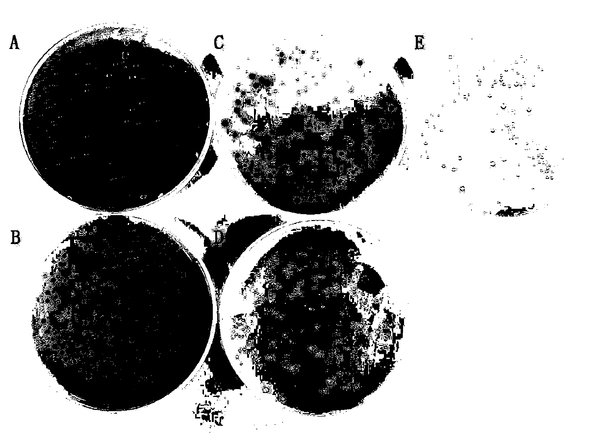 Method for acquiring transgenic antibacterial peptide chlorella mediated by magnetic nanoparticles