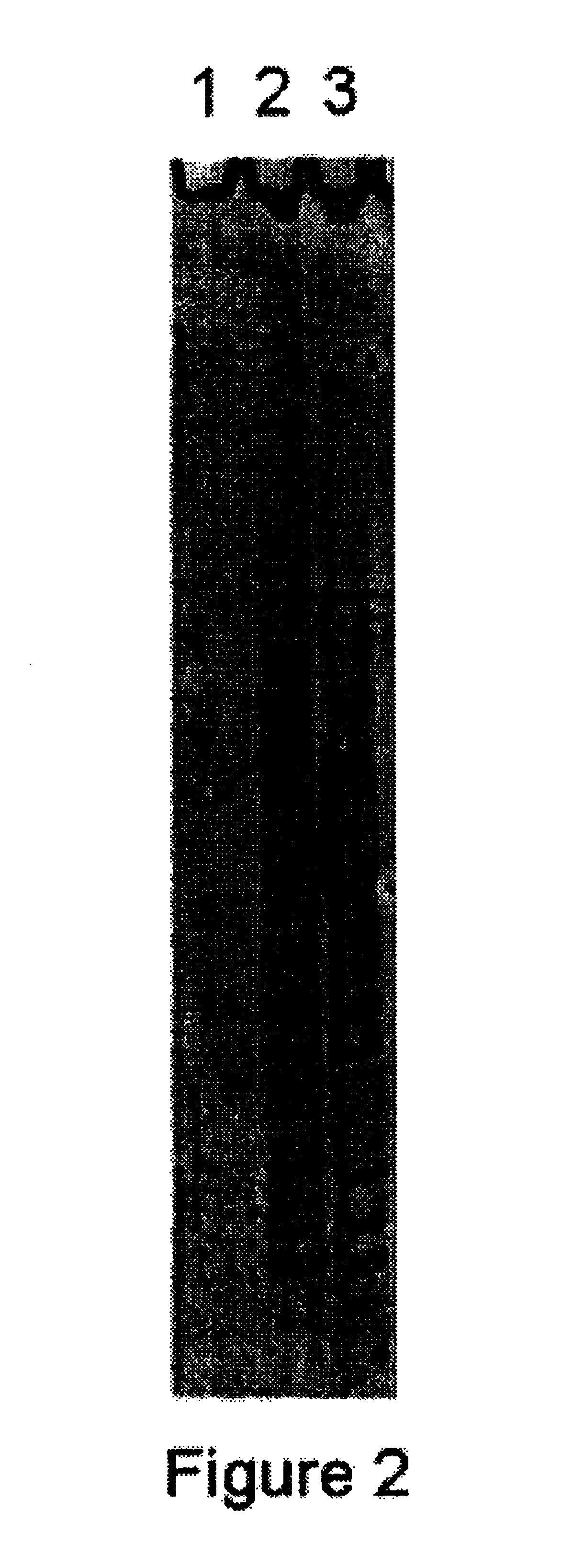 Methods for detection of nucleic acid sequences in urine