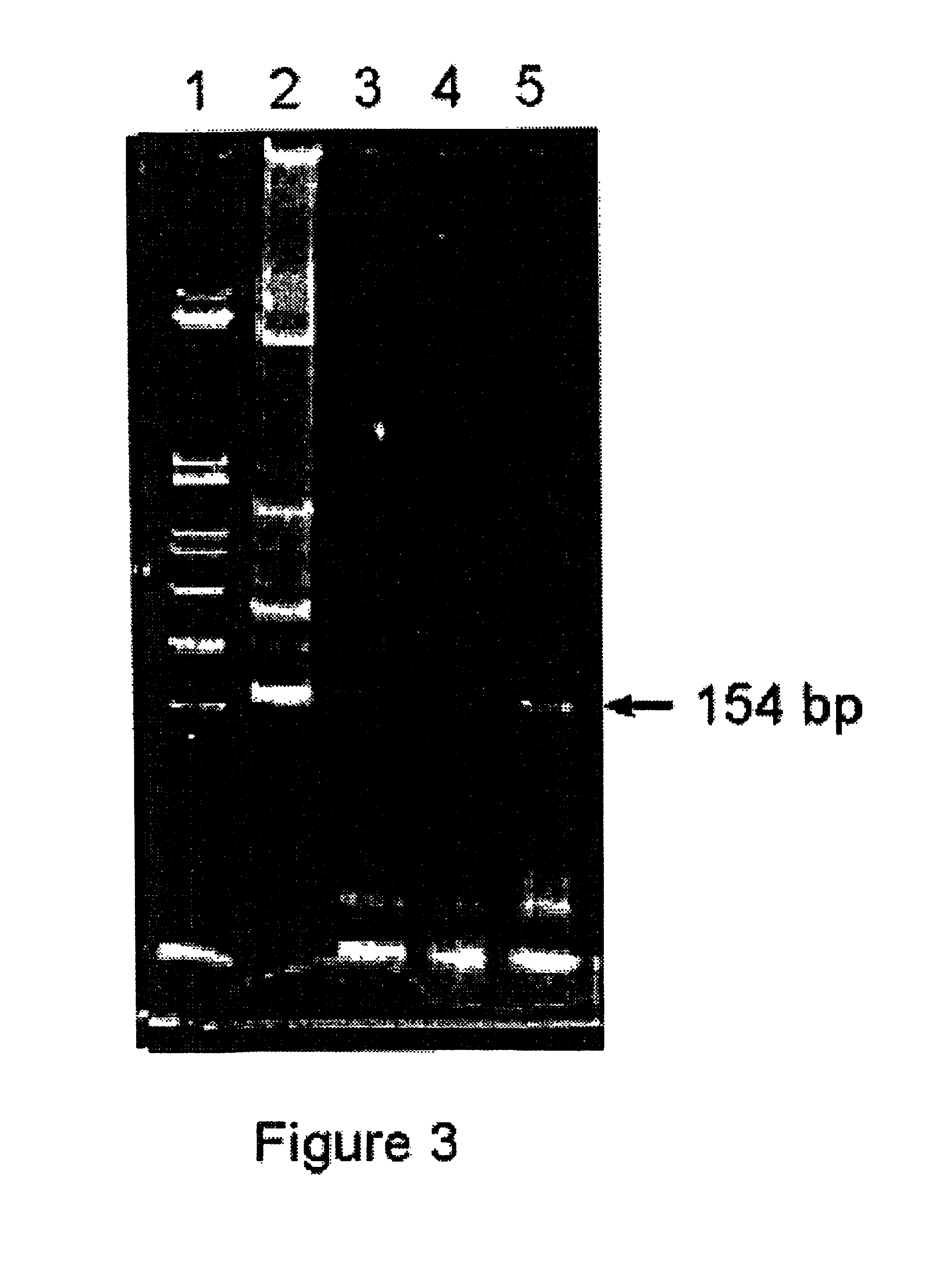 Methods for detection of nucleic acid sequences in urine
