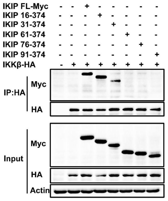 Short peptide targeting ikkβ and its application in inflammatory diseases