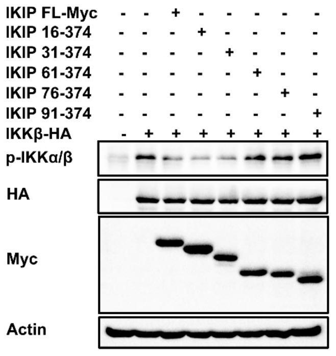 Short peptide targeting ikkβ and its application in inflammatory diseases