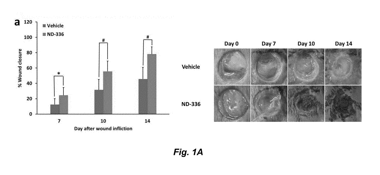Acceleration of diabetic wound healing