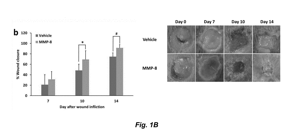 Acceleration of diabetic wound healing