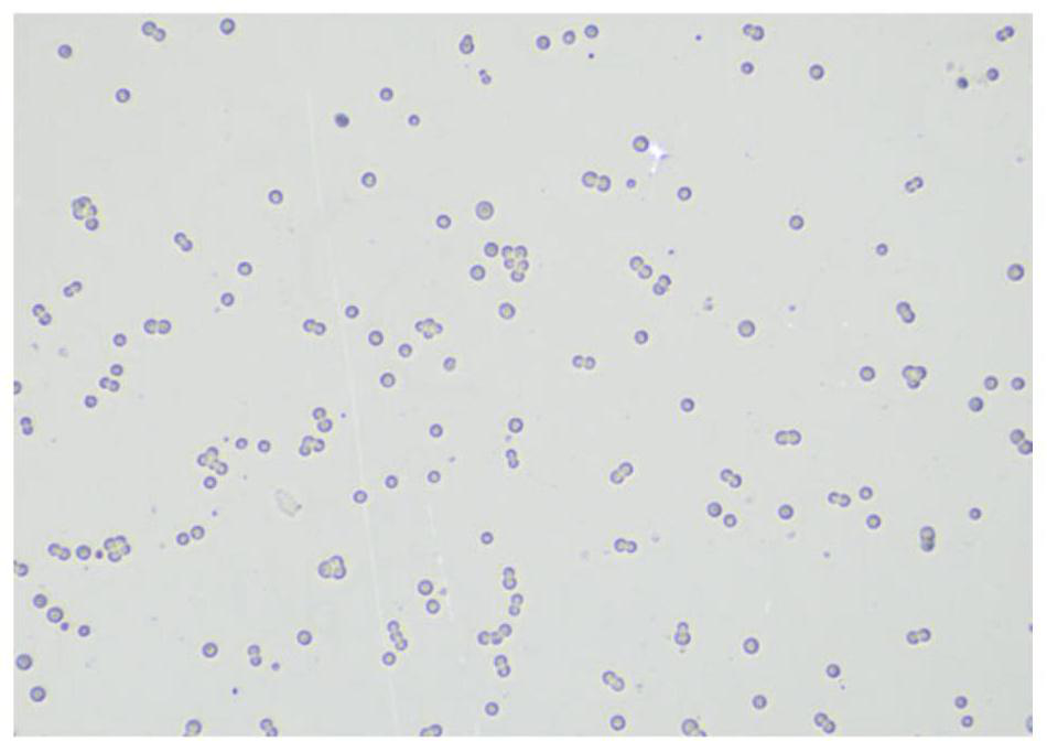 Rapid domestication method for HEK293T cell suspension and serum-free culture and application of rapid domestication method