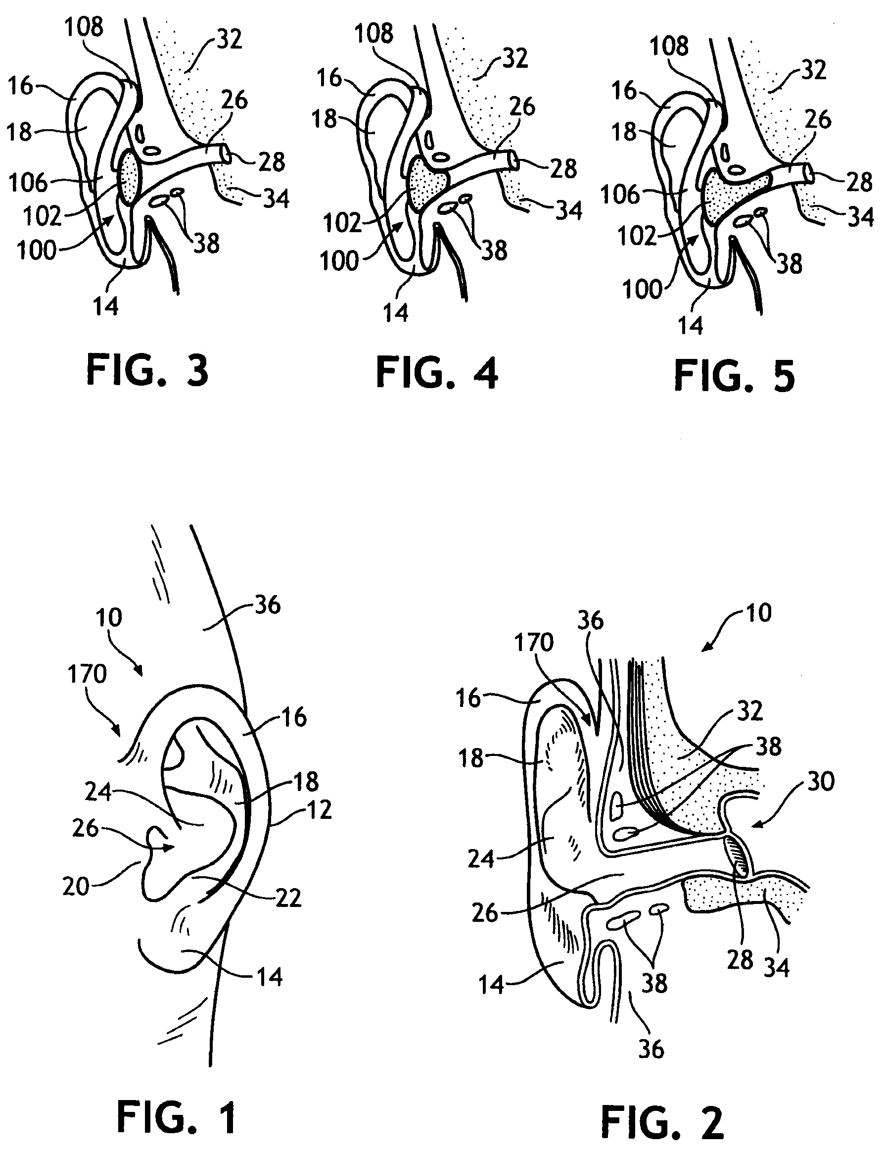 Bandless hearing protector and method