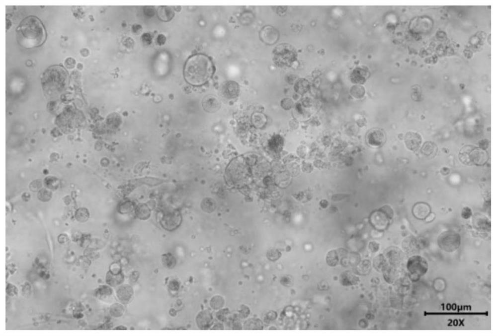 A special culture medium and culture method for lung cancer organoids