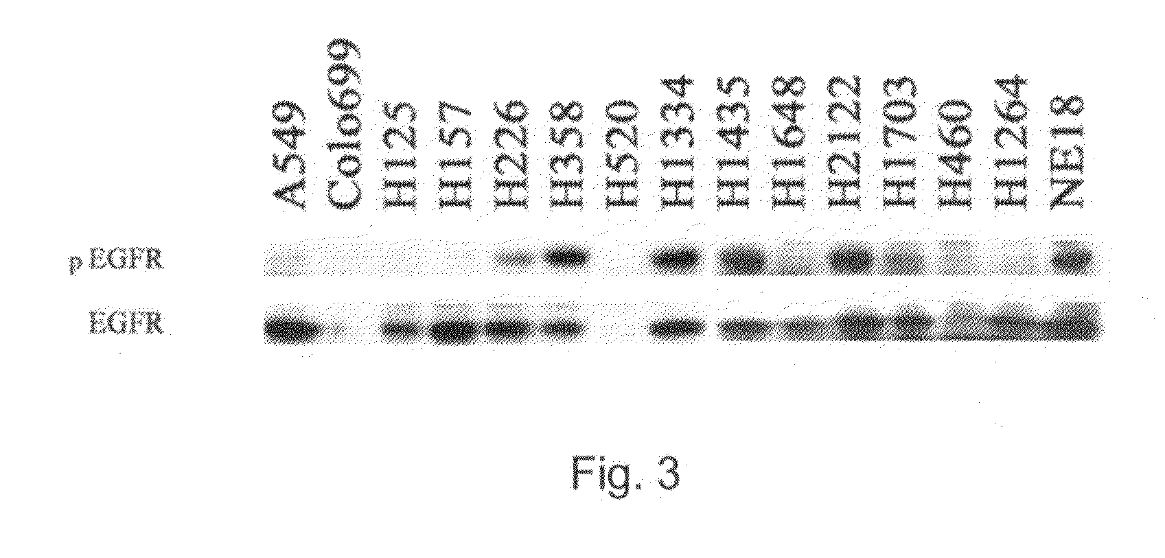 Gefitnib Sensitivity-Related Gene Expression and Products and Methods Related Thereto