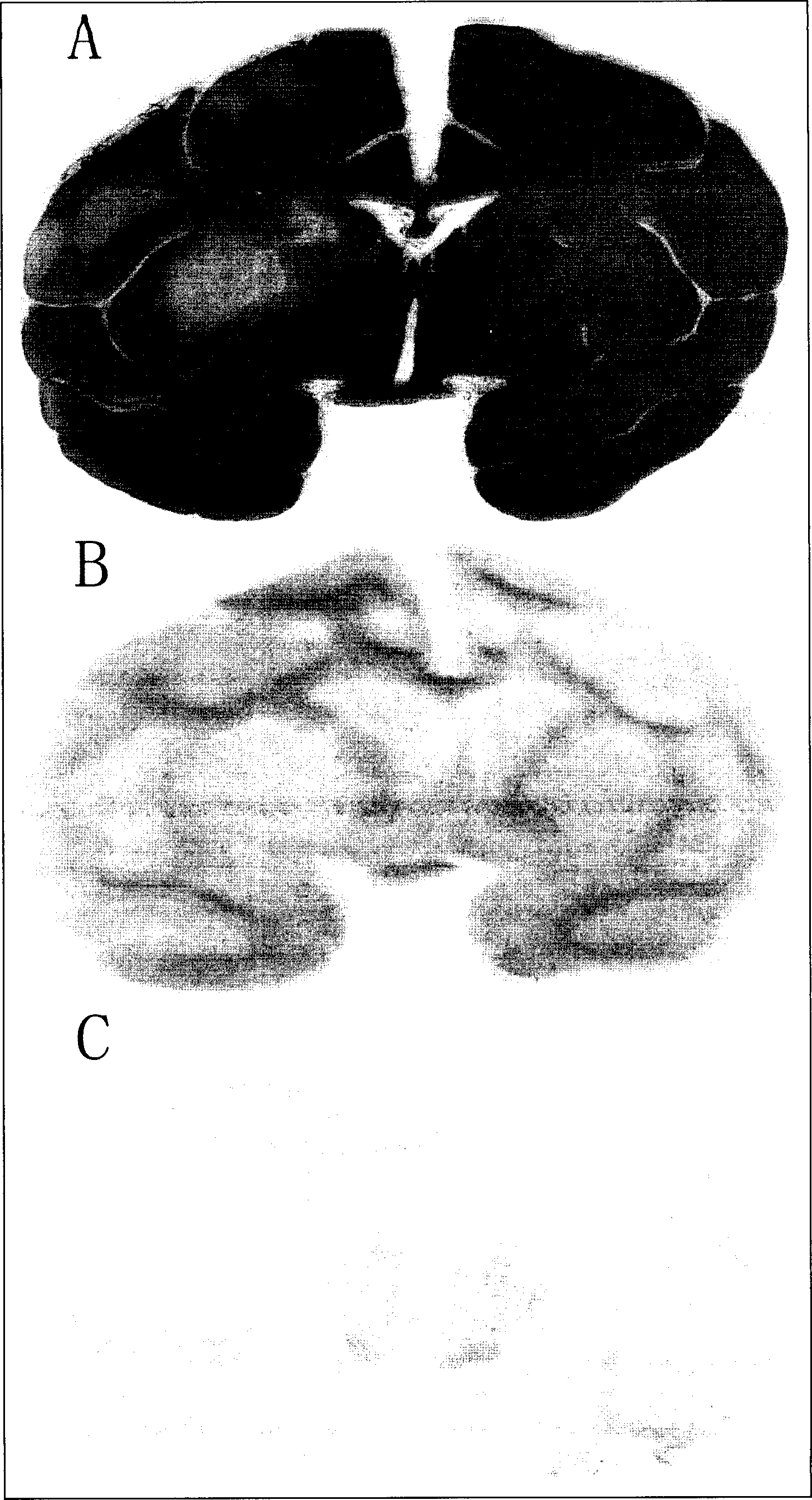 Method for making molecular hybridization using stained old cerebotissue section and its use