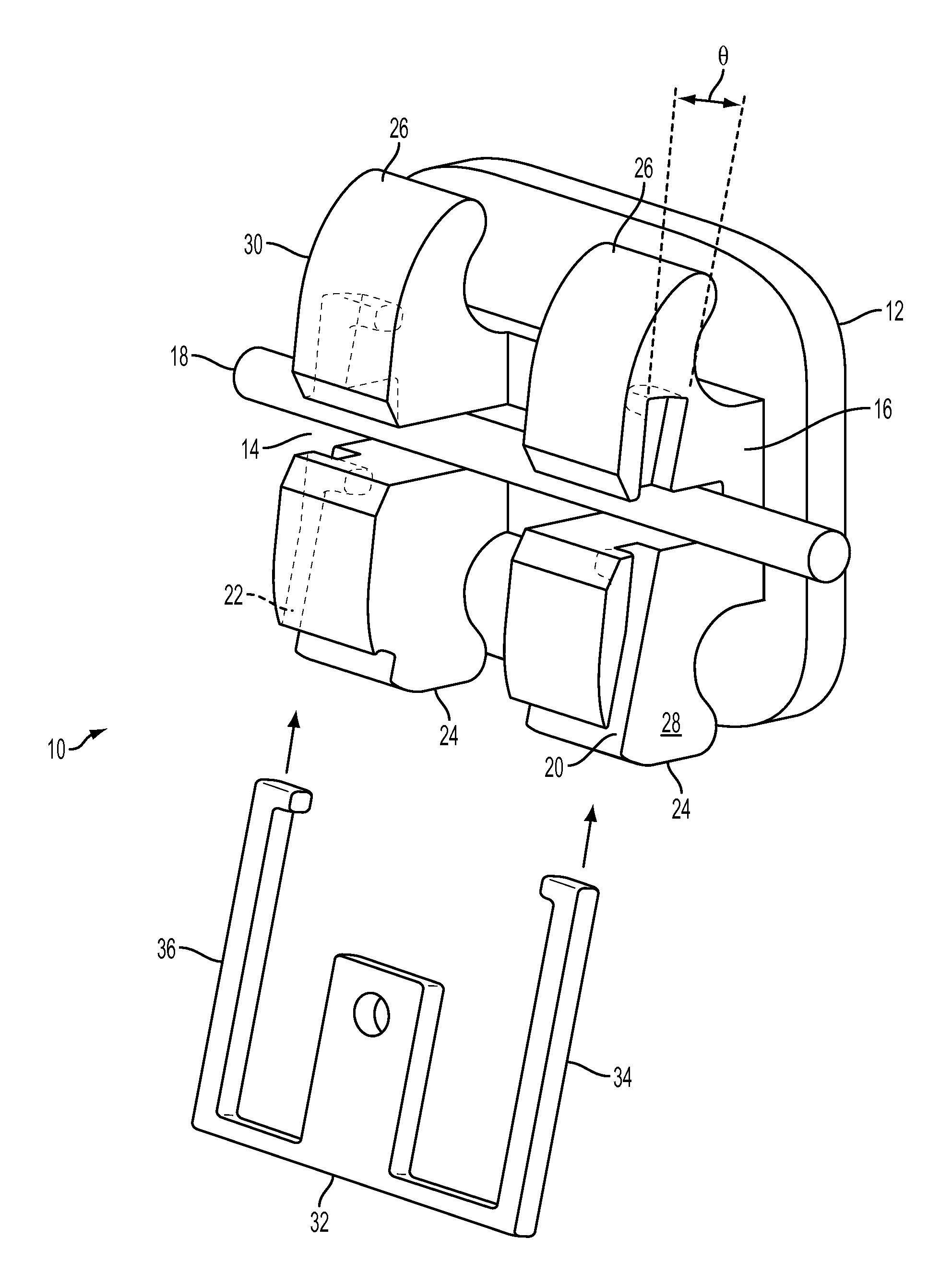 Orthodontic Bracket with Angled, Curved Shutter