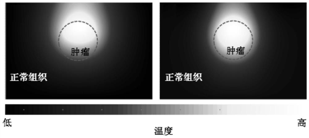 Biological tissue temperature field passive regulation and control method based on optical phase change nanoparticles