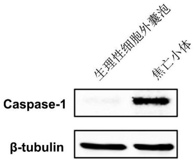 A method for preparing extracellular vesicles and its application