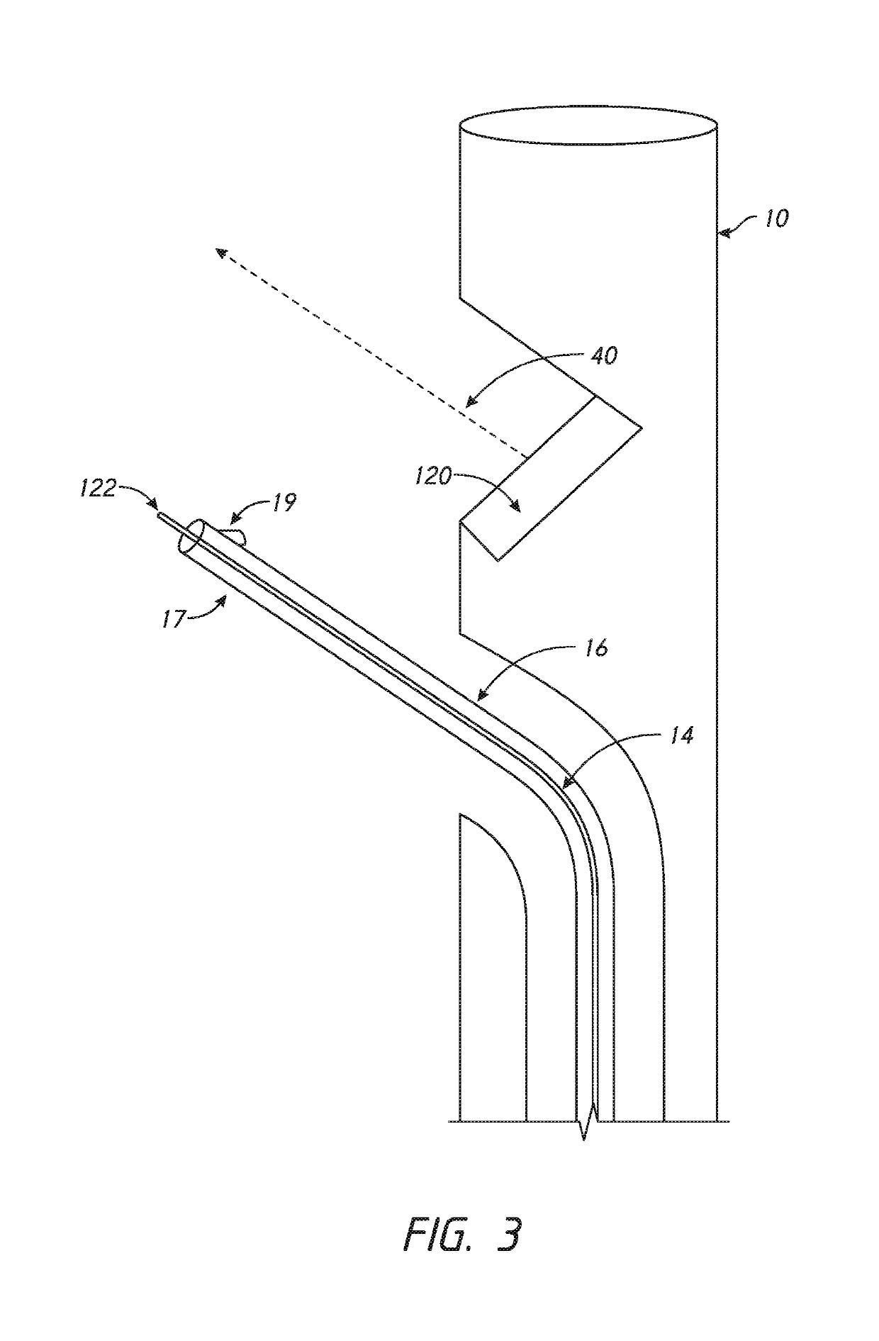 Devices and methods for treating lower extremity vasculature