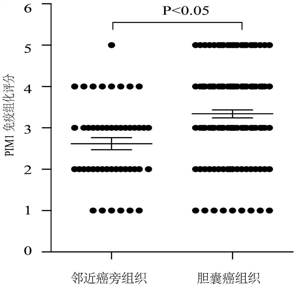 Gallbladder cancer diagnostic and prognostic marker pim1