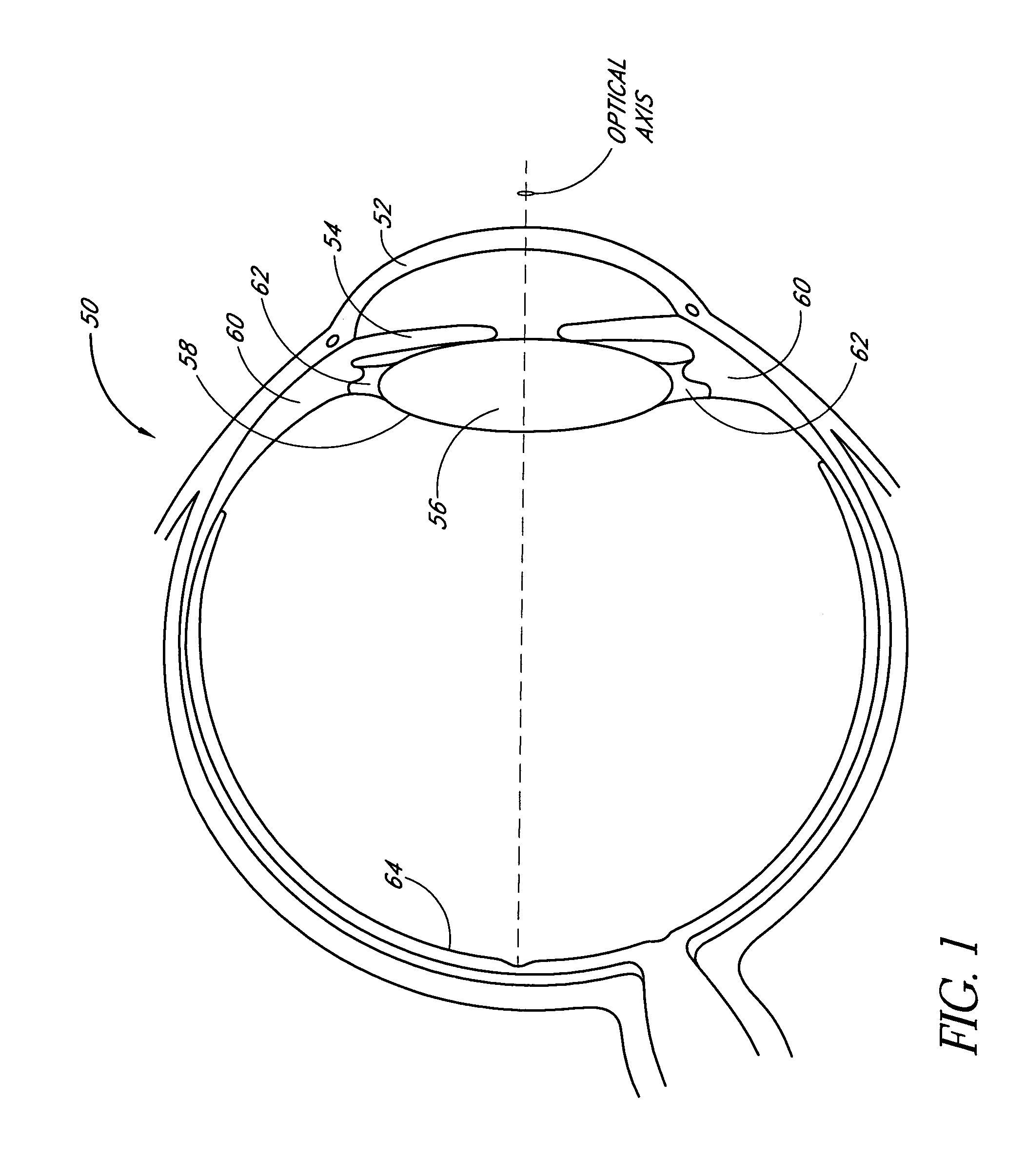 Method of implanting an intraocular lens