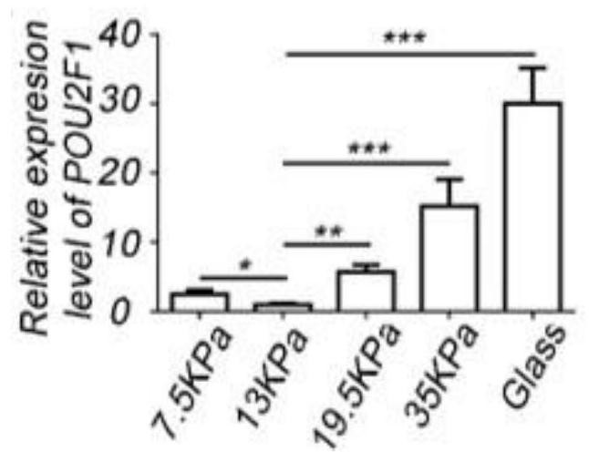 Application of pou2f1 gene expression inhibitor in the preparation of medicaments for the treatment of tissue fibrosis