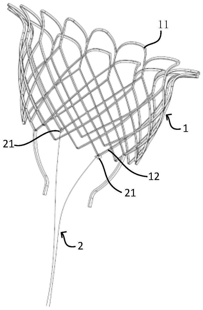 Mitral valve interventional valve and delivery system