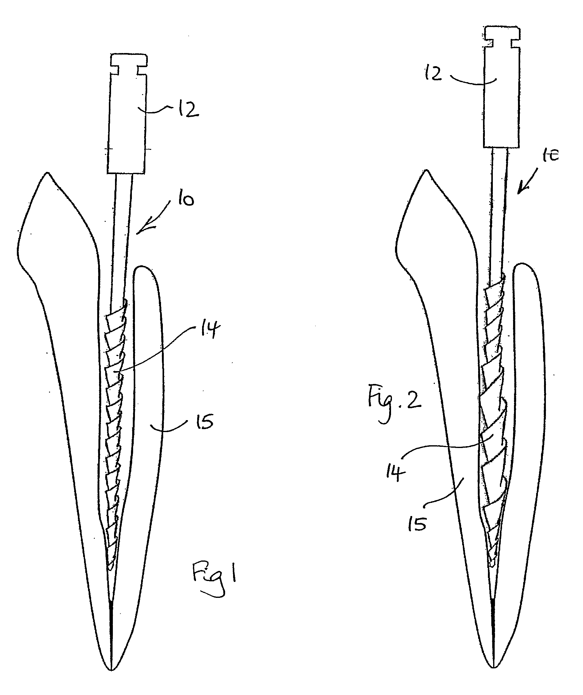 Dental apparatus for shaping and cleaning a root canal