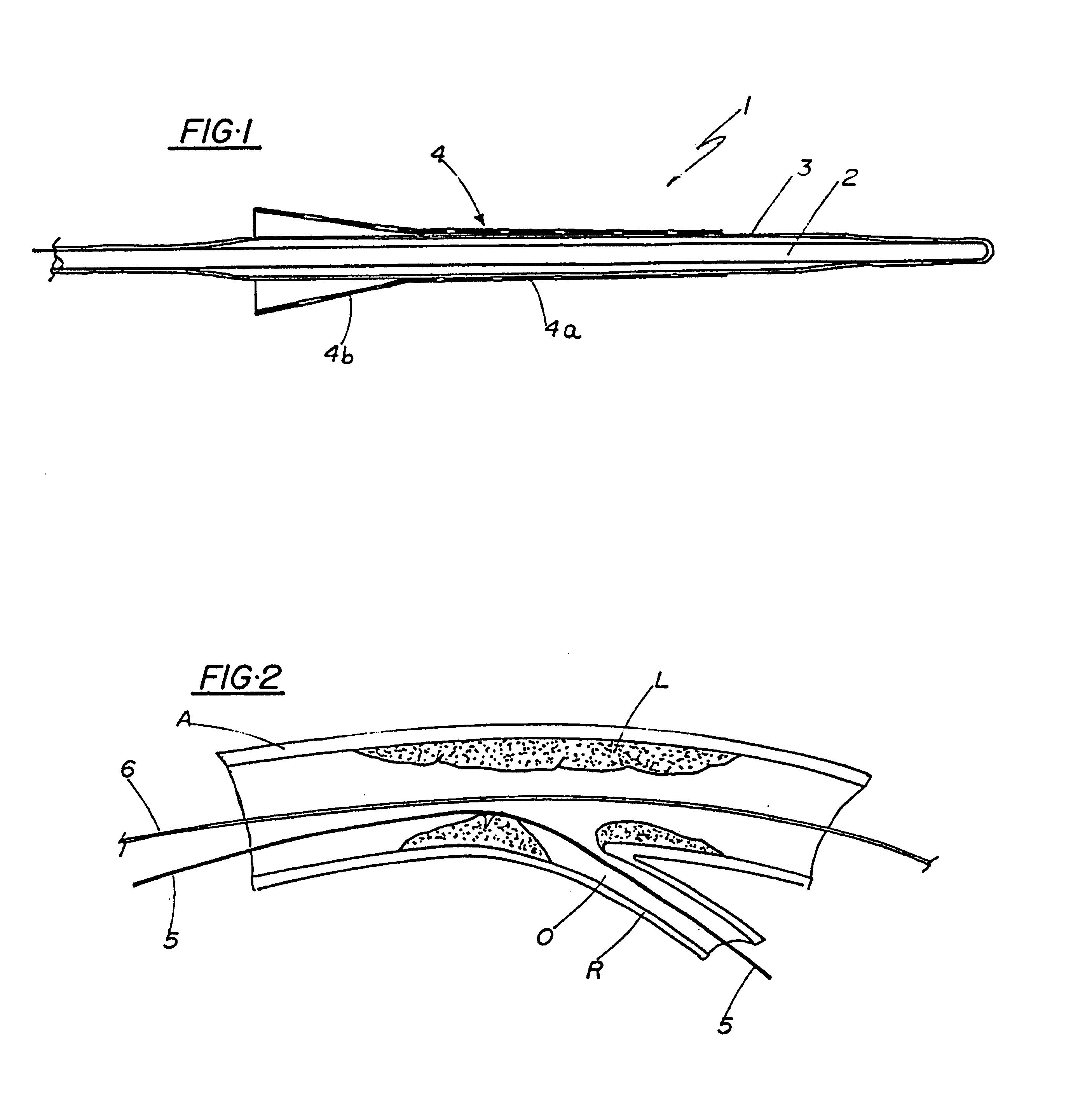 Device for disobstruction of ateriosclerotic lesions which incorporate the origin of lateral branches, or which are located in bifurcation of the coronary circulation, and respective interventionist process of placing such device
