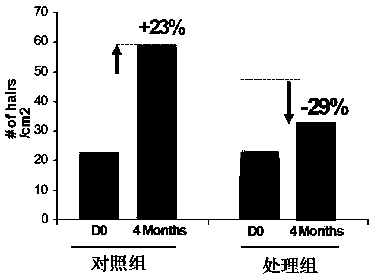 Anti-hairloss composition and preparation method