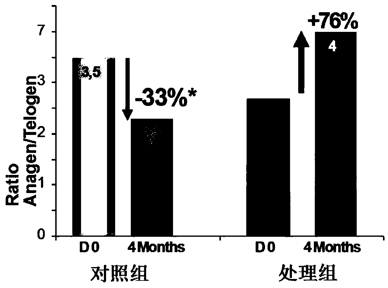 Anti-hairloss composition and preparation method