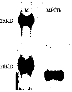 Meloidogyne jauanica effect gene Mj-ttl, encoded protein and application of meloidogyne jauanica effect gene Mj-ttl