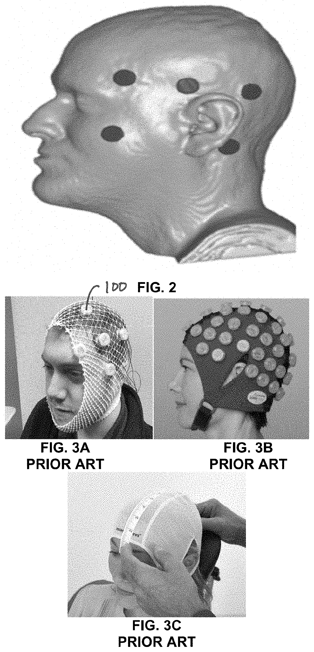 Neuropsychological and neurological rehabilitation headgear device