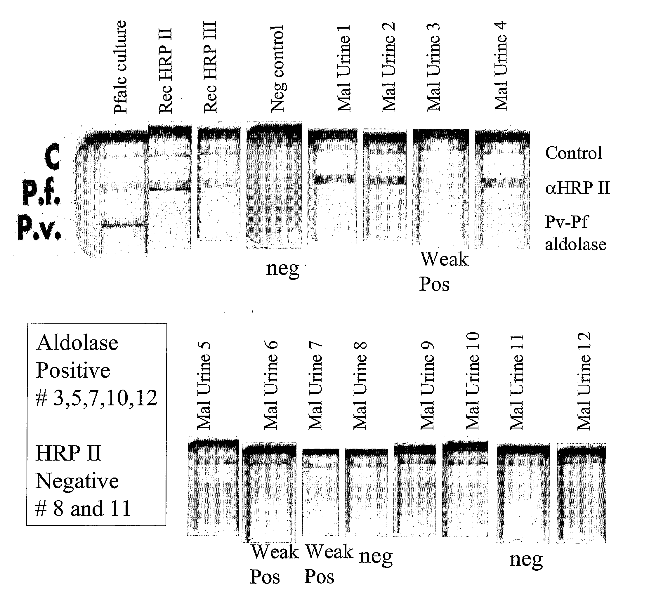 Plasmodium Diagnostic Assay Device