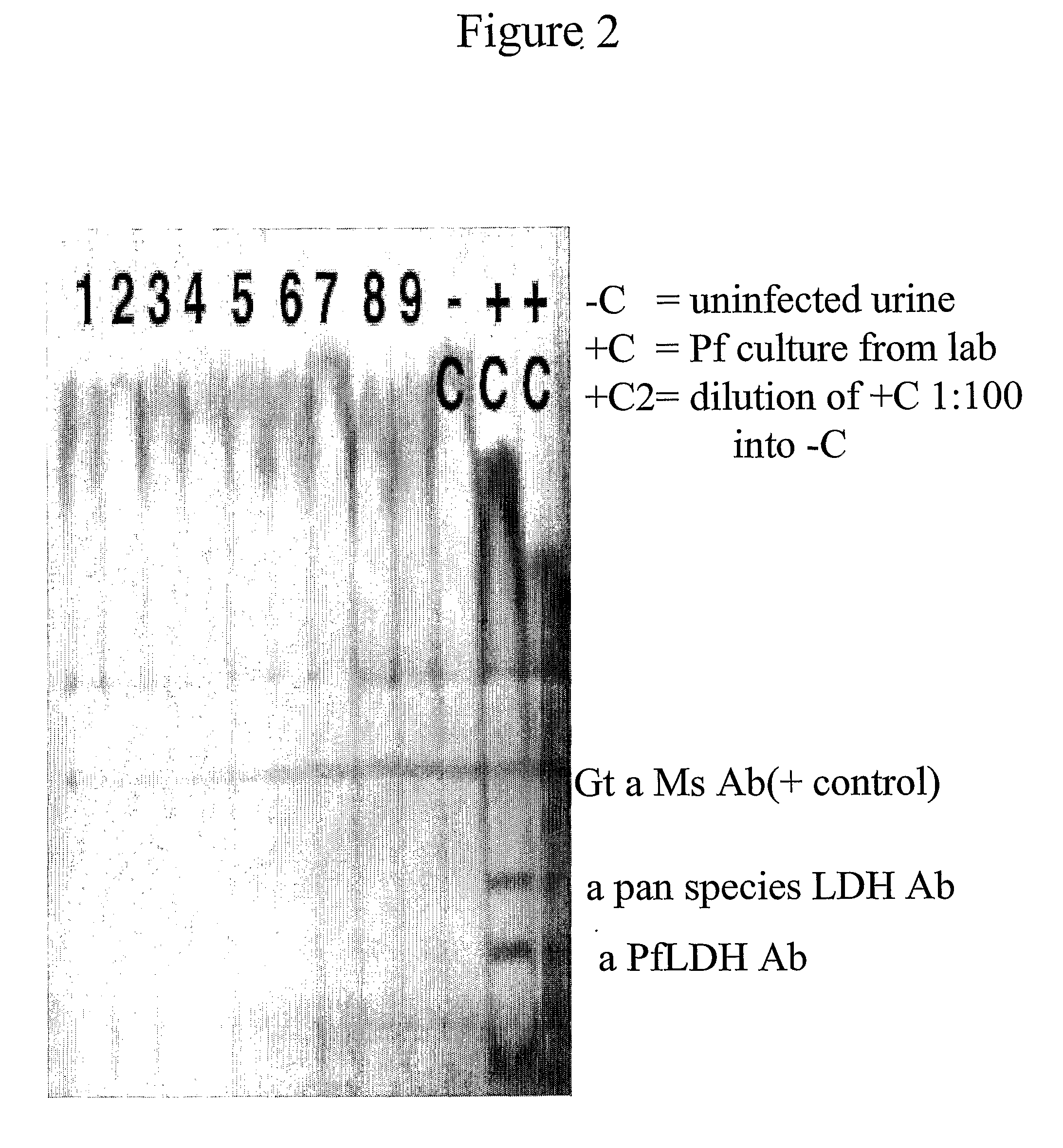 Plasmodium Diagnostic Assay Device