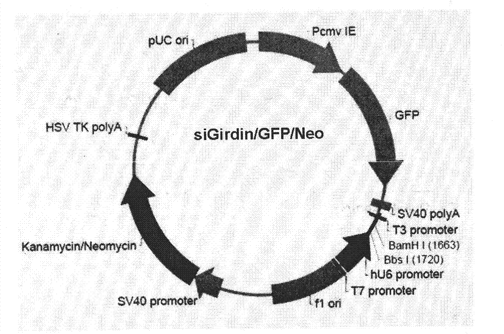 Cytoskeletal binding protein siRNA (small interfering ribonucleic acid) interfering sequence, fusion expression vector thereof and medical application of same