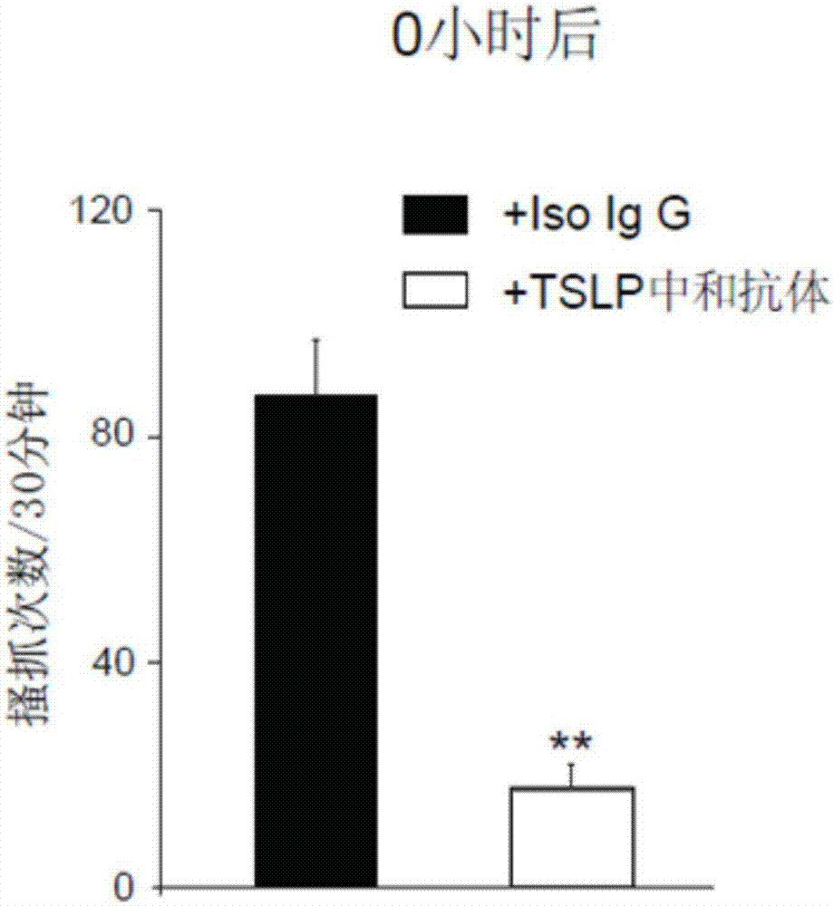 Application of anti-TSLP antibody in preparation of drugs for treating chronic pruritus