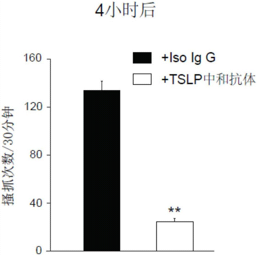 Application of anti-TSLP antibody in preparation of drugs for treating chronic pruritus