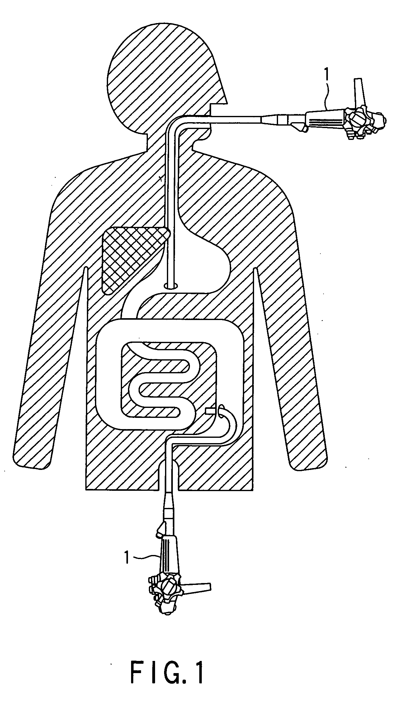Endoscopic system for treating inside of body cavity